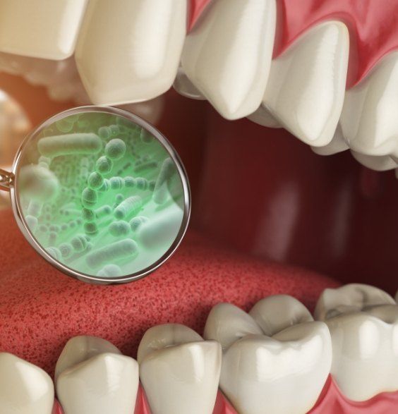 Illustrated close up of mouth with highlighted green bacteria