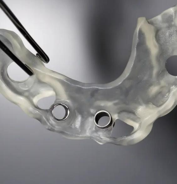 Close up of clear 3 D printed dental implant surgical guide