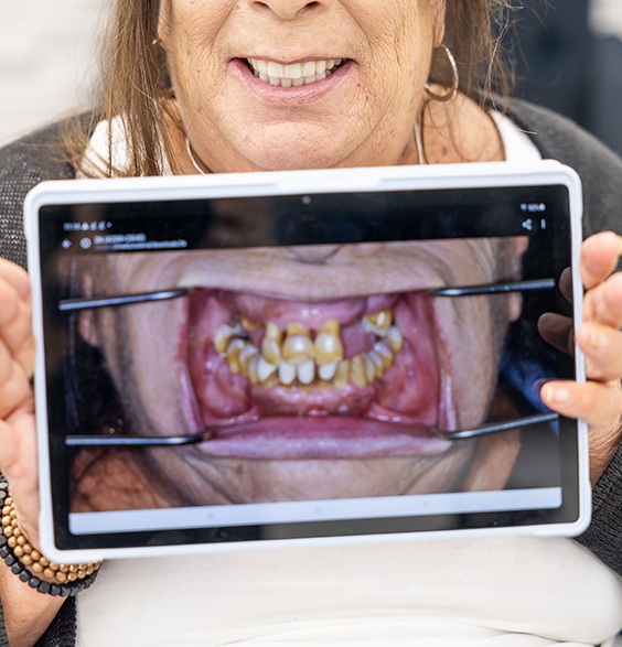 Person holding tablet showing photo of mouth with severely decayed teeth and some missing teeth